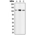 LifeSab™ Phospholipase D2 (pY169) Rabbit pAb (50 µl)