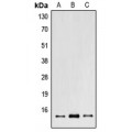 LifeSab™ POLR2I Rabbit pAb (50 µl)