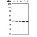 LifeSab™ PPP2CA (pY307) Rabbit pAb (50 µl)