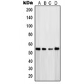 LifeSab™ PTEN Rabbit pAb (50 µl)