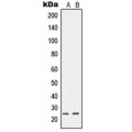 LifeSab™ RIT1 Rabbit pAb (50 µl)