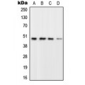 LifeSab™ RPL3 Rabbit pAb (50 µl)