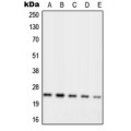LifeSab™ RPL10 Rabbit pAb (50 µl)