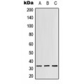 LifeSab™ RPS3 Rabbit pAb (50 µl)