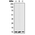 LifeSab™ RPS19 Rabbit pAb (50 µl)