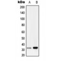 LifeSab™ RRAD Rabbit pAb (50 µl)