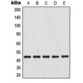 LifeSab™ MKK4 Rabbit pAb (50 µl)