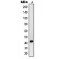 LifeSab™ Beta-sarcoglycan Rabbit pAb (50 µl)