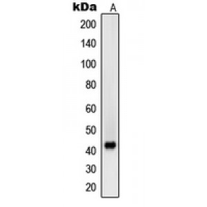 LifeSab™ Beta-sarcoglycan Rabbit pAb (50 µl)
