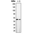 LifeSab™ GLUT1 Rabbit pAb (50 µl)