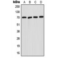 LifeSab™ Acid Sphingomyelinase Rabbit pAb (50 µl)