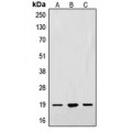 LifeSab™ Alpha-synuclein Rabbit pAb (50 µl)