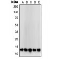 LifeSab™ SOD1 Rabbit pAb (50 µl)
