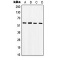 LifeSab™ SOX9 (pS181) Rabbit pAb (50 µl)