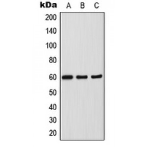 LifeSab™ SOX11 Rabbit pAb (50 µl)