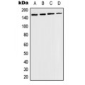 LifeSab™ TIE2 (pY1108) Rabbit pAb (50 µl)