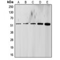LifeSab™ ALK5 Rabbit pAb (50 µl)