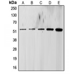 LifeSab™ ALK5 Rabbit pAb (50 µl)