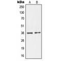 LifeSab™ NKX2-1 Rabbit pAb (50 µl)
