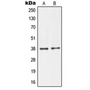 LifeSab™ NKX2-1 Rabbit pAb (50 µl)