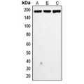 LifeSab™ Topoisomerase 2 alpha Rabbit pAb (50 µl)