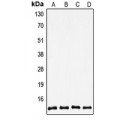 LifeSab™ Thioredoxin 1 Rabbit pAb (50 µl)