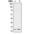 LifeSab™ UBE2A/B Rabbit pAb (50 µl)