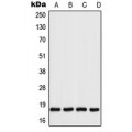 LifeSab™ UBC9 Rabbit pAb (50 µl)