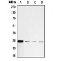 LifeSab™ PGP9.5 Rabbit pAb (50 µl)