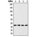 LifeSab™ UGCG Rabbit pAb (50 µl)