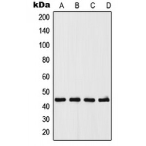 LifeSab™ UGCG Rabbit pAb (50 µl)