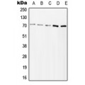 LifeSab™ ZAP70 (pY315) Rabbit pAb (50 µl)
