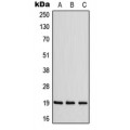 LifeSab™ ZNF9 Rabbit pAb (50 µl)