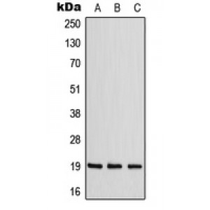 LifeSab™ ZNF9 Rabbit pAb (50 µl)