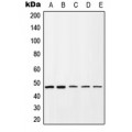 LifeSab™ CD184 (pS339) Rabbit pAb (50 µl)