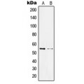 LifeSab™ KLF11 Rabbit pAb (50 µl)