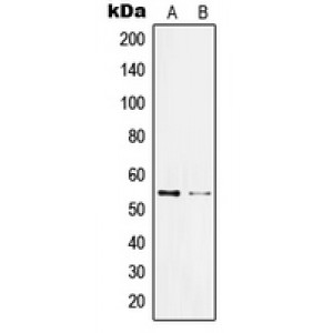 LifeSab™ KLF11 Rabbit pAb (50 µl)