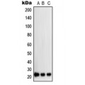 LifeSab™ SOCS2 Rabbit pAb (50 µl)
