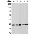 LifeSab™ SOCS3 Rabbit pAb (50 µl)