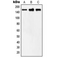 LifeSab™ MYOM2 Rabbit pAb (50 µl)