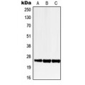 LifeSab™ LRAT Rabbit pAb (50 µl)