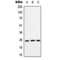 LifeSab™ RAB33A Rabbit pAb (50 µl)