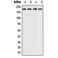 LifeSab™ ROCK2 Rabbit pAb (50 µl)