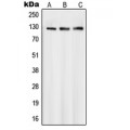 LifeSab™ SMG7 Rabbit pAb (50 µl)