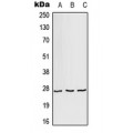 LifeSab™ AKR1A1 Rabbit pAb (50 µl)