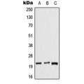 LifeSab™ DUSP14 Rabbit pAb (50 µl)