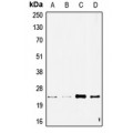 LifeSab™ STMN2 Rabbit pAb (50 µl)