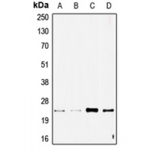LifeSab™ STMN2 Rabbit pAb (50 µl)