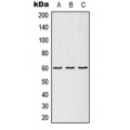 LifeSab™ TCP1 epsilon Rabbit pAb (50 µl)