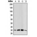 LifeSab™ CABP4 Rabbit pAb (50 µl)